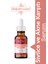Sivilce Akne Karşıtı Serum 30 ml 1