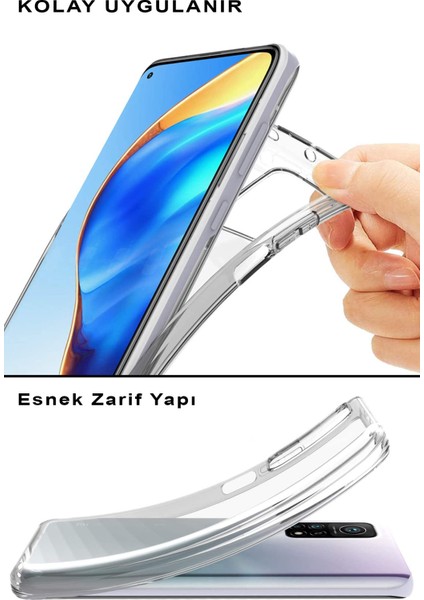 Xiaomi Mi Note 10 Lite ile Uyumlu Kapak Sevimli Karakterler Tasarımlı Şeffaf Silikon Kılıf