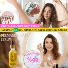 Dermanew 3 Adet Serum + Roller Dermanew hair Bayanlara Özel Serum