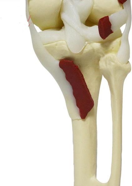 Kaslı Diz Maketi Model 31 indirimleri