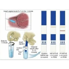 Amnisure Fetal Membran Yırtığı Testi