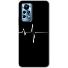 Gramaphone Infinix Note 11 Pro Kılıf Hd Desen Baskılı Arka Kapak - Heart Rytm