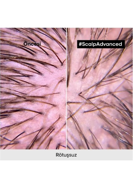 Serie Expert Scalp Advanced Profesyonel Şampuan 500ML