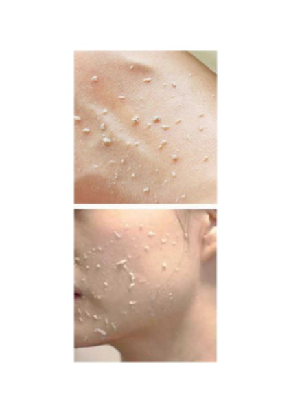 Peeling Gel 75 ml fiyatları