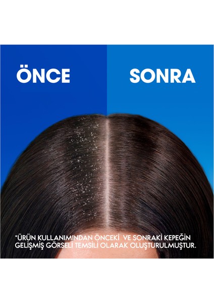 Head & Shoulders Klasik Bakım Kepek Karşıtı 750ML Günlük Kullanım Şampuan