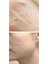 Peeling Gel 75 ml 2