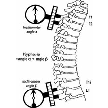 Fizyofiplus Inclinometre Lordoz ve Ölçüm Metre