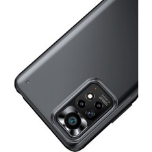 Case 4U Xiaomi Redmi Note 11 / 11S Kılıf Darbe Koruyucu Arkası Buzlu Silikon Volks Arka Kapak Siyah