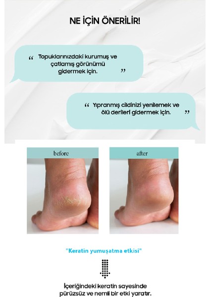 Kuru Ve Çatlak Ayaklar Için Nemlendirici Onarıcı Ayak Bakım Kremi fiyatları