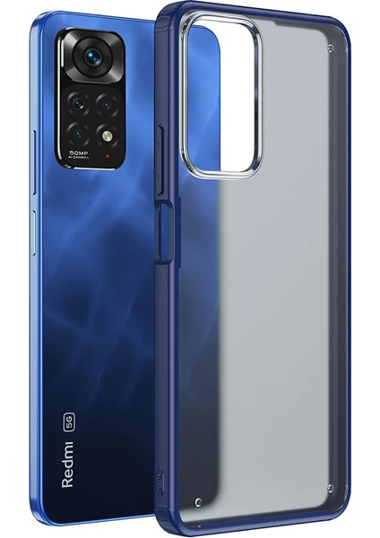 Case 4U Xiaomi Redmi Note 11 Pro 5g Kılıf Darbe Koruyucu Arkası Buzlu Silikon Volks Arka Kapak Lacivert