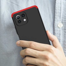 Voyo Xiaomi Mi 11 Lite Kılıf 3 Parçalı Tam Kaplayan Kapak Voyas