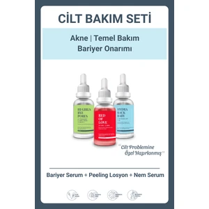 She Vec Bariyer Onarımı | | Temel Bakım