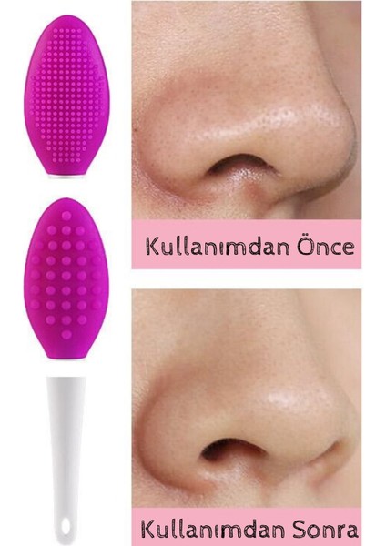 Lusso Cosmetics Cilt Temizleme Fırçası + Burun Siyah Nokta Temizleyici Dudak Peeling Fırça- Koyu Pembe