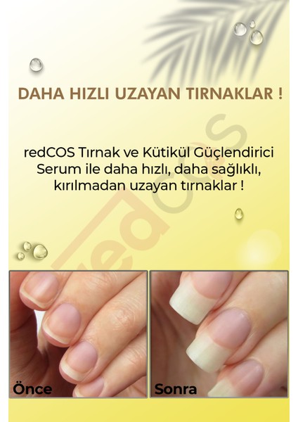Tırnak Ve Kütikül Güçlendirici Aktif Serum