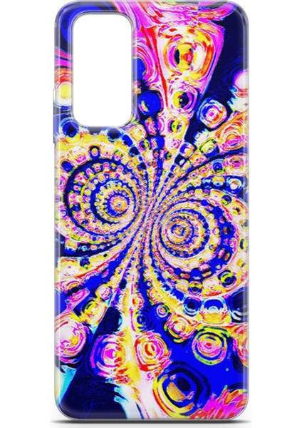 Xiaomi Redmi Note 11S Kılıf Uv Baskılı Abxbi 1 Kapak Renkli Hipnoz