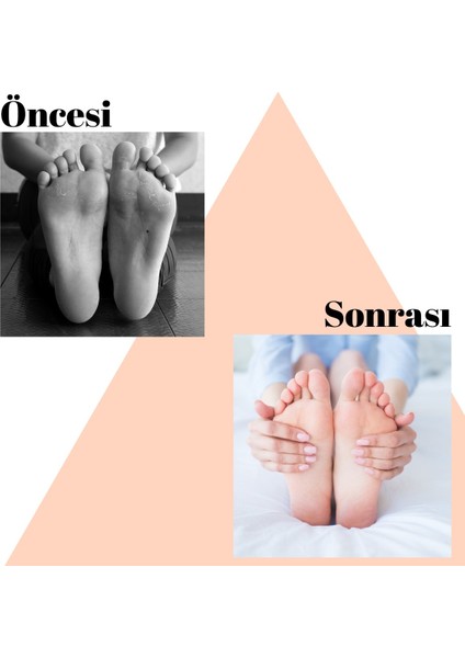 Ayak Parmak Koruyucu Silikon - Ayakkabı Vurma Önleyici Çift Ped indirimleri