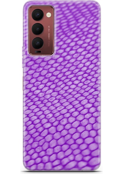 Tecno Camon 18 Kılıf Uv Baskılı Abxbi 10 Telefon Kabı Mor Petek