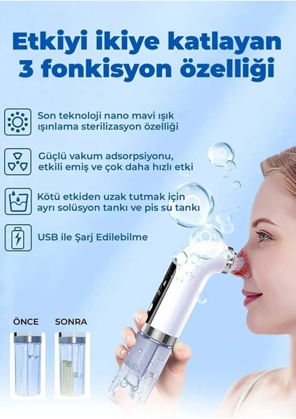 Sterilizasyonlu Vakumlu Cilt Gözenek Siyah Nokta Temizleyici fırsatları