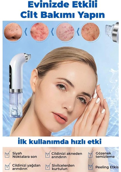 Sterilizasyonlu Vakumlu Cilt Gözenek Siyah Nokta Temizleyici