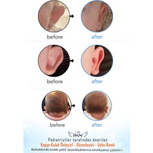 Halzey Bebek Kepçe Kulak Bandı / Kepçe Kulak Önleyici Ayarlanabilir Cırtları Sayesinde 0- 2 Yaş Arası Uygun