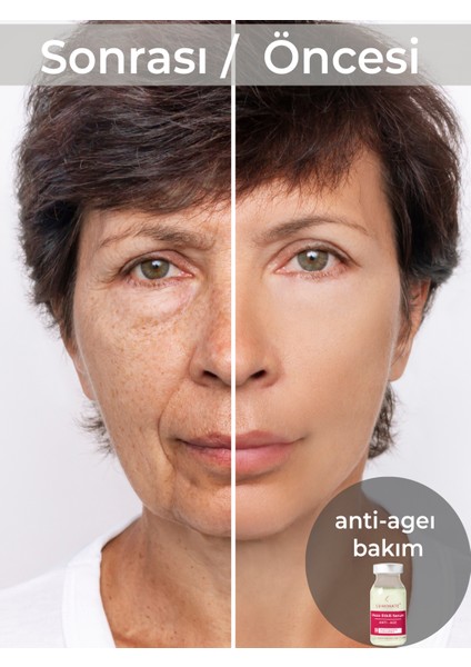 Anti-Age Cilt Serum Niaciamide Hyaluron Kolajen Yaşlanma Önleyici ve Gençleştirici Krem 5*8 ml indirimleri