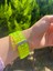 Apple Watch Uyumlu Sarı Şeffaf Kordon 42-44-45 mm 2