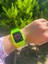 Apple Watch Uyumlu Sarı Şeffaf Kordon 42-44-45 mm 3
