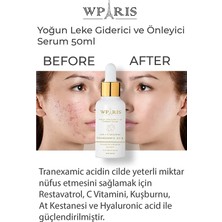 Wparis Onyx  Leke Önleyici Serum Lha + C Vitamini 50 ml