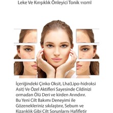 Wparis Leke ve Iz Önleyici Lha & Çinko Oksitli Tonik 110ML