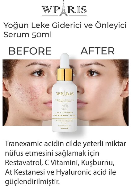 Onyx Leke Önleyici Serum Lha + C Vitamini 50 ml