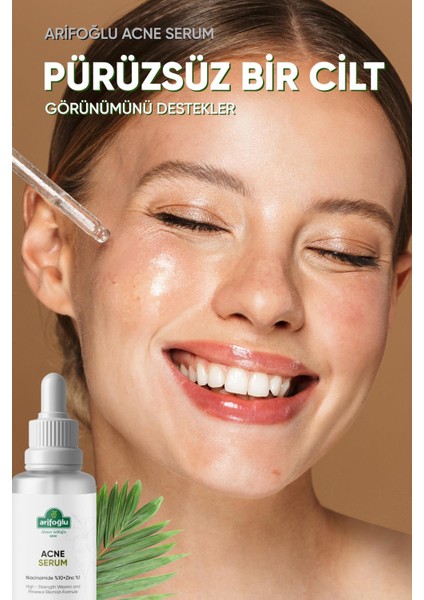 Akne Karşıtı Serum 30 ml (Sivilce, Siyah Nokta, Akne Karşıtı ) Niacinamide %10+Zinc %1 fiyatları