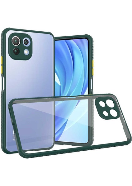 Xiaomi Mi 11 Lite Kılıf Köşe ve Kamera Korumalı Arkası Şeffaf Renkli Tuşlu Silikon Kapak (Kaff) fiyatları