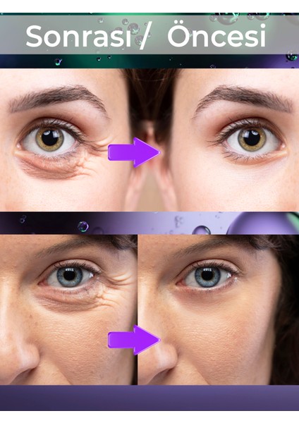 Hyaluronik Göz Altı Serumu Göz Çevresi Nemlendirici Yaşlanma Karşıtı 20 ml