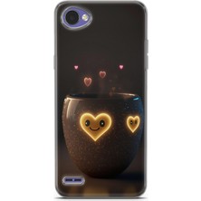 Denza Case Lg Q6 Uyumlu Kılıf Hd Baskılı Kılıf - Aşk Yuvası