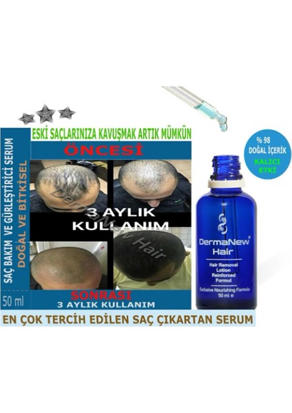 Dermanew Hair Saç Losyon Bakım 3 Adet Serum + Roller 3X50ML fırsatları