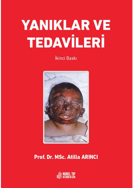 Yanıklar ve Tedavileri - Atilla Arıncı