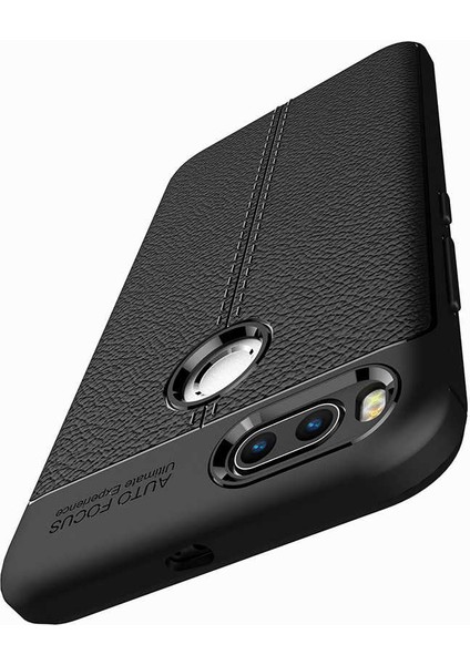 Xiaomi Mi 5x Kılıf Deri Görünümlü Renk Atmayan Dayanaklı Silikon Kapak (Niss) fırsatları