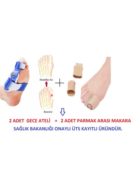 Baş Parmak Kemik Düzeltici Silikon Parmak Arası Makara