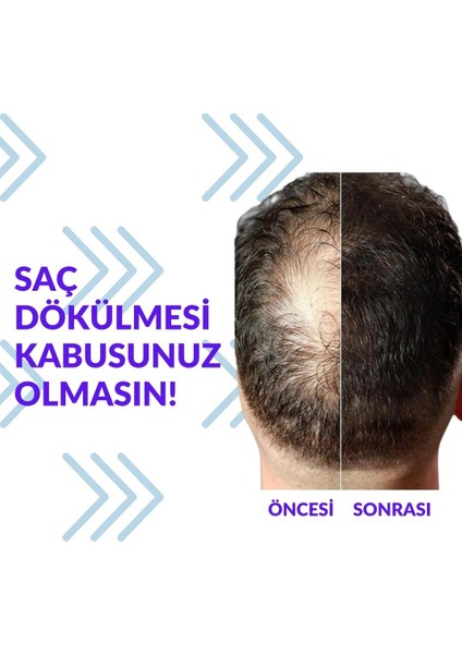 Minoxıdıl %5 Pak Darou 60 ml (Orjinal Arapça Damgalı) modelleri