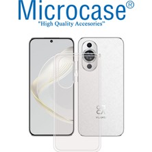 Microcase Huawei Nova 11 Slim Serisi Soft Tpu Silikon Kılıf - Şeffaf AL3324