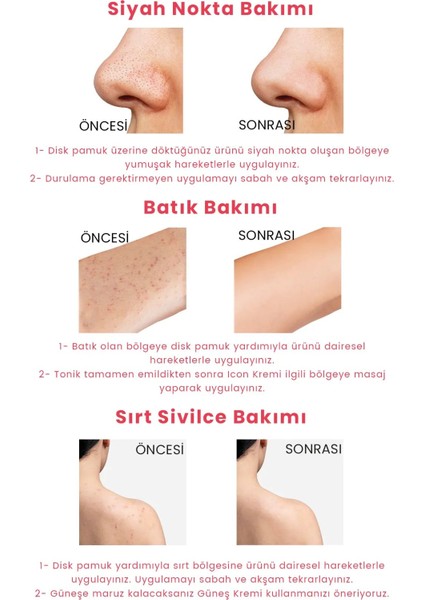 Procsın Hydro Solution Babypore Canlandırıcı %7 Glikolik Asit Ginseng Tonik 200ML