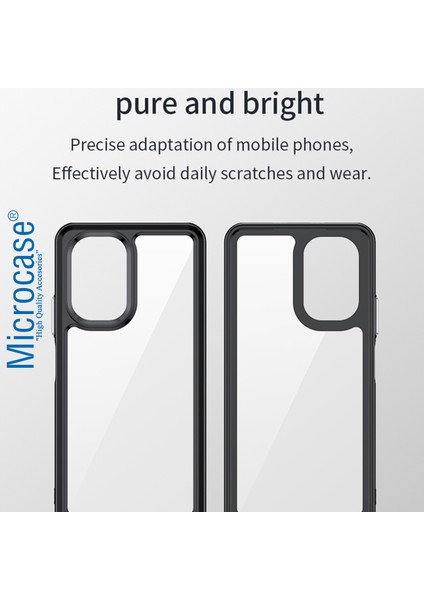 Xiaomi Redmi Note 12S 4g Shield Serisi Darbeye Dayanıklı Yarı Esnek Plastik Tpu Kılıf - AL8100 fırsatları