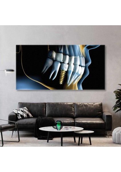 Diş Hekimi Ofisi Gold Implant Ağız ve Diş Sağlığı Kanvas Tablo