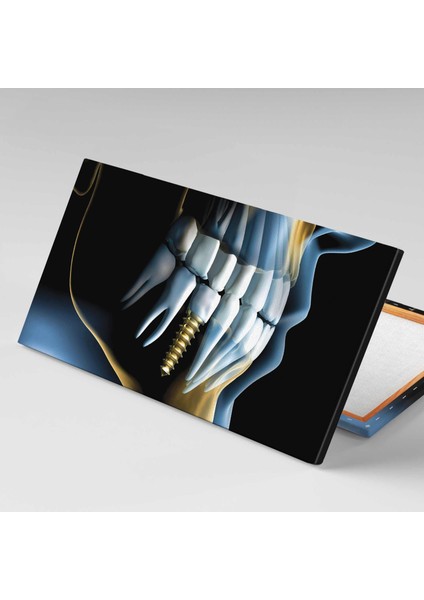 Diş Hekimi Ofisi Gold Implant Ağız ve Diş Sağlığı Kanvas Tablo fiyatları