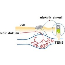 Medipal Tens Pedi - 5x5 cm Soketli - Acura, Eragon, Alllife, Nordmende, Optimed, Wollex Uyumlu