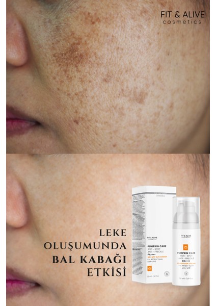 Lekeli Ciltlere Özel Aydınlatıcı Pumpkin Güneş Kremi Spf 50+ (Anti Spot & Anti Freckles)