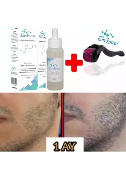 Sakal Çıkaran Serum Yanında Demaroller