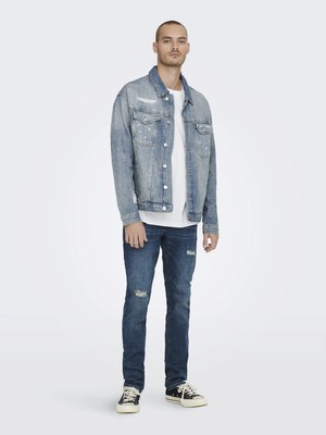 Only & Sons Erkek Kot Ceket 22023244