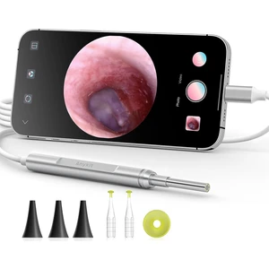 Dijital Otoskop, Ultra Net Görüşlü Kulak Kamerası - Ipad/iphone/android
