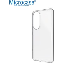 Microcase Honor 90 Slim Serisi Soft Tpu Silikon Kılıf - Şeffaf AL3324